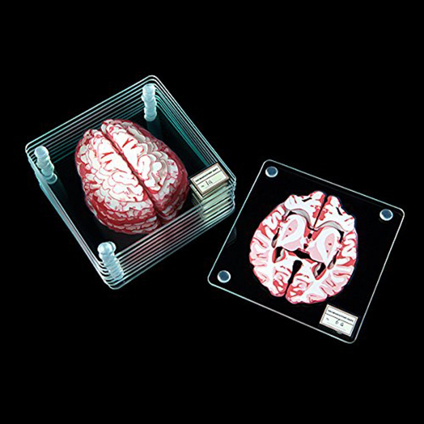 Brain Specimen Coasters - OddGifts.com